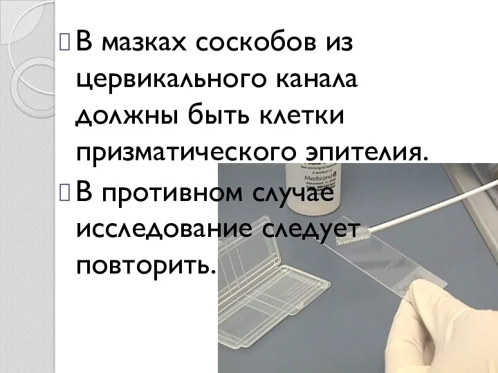 В мазках соскобов из цервикального канала должны быть клетки призматического