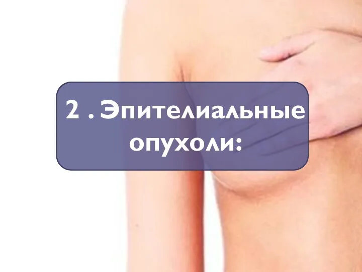 2 . Эпителиальные опухоли: