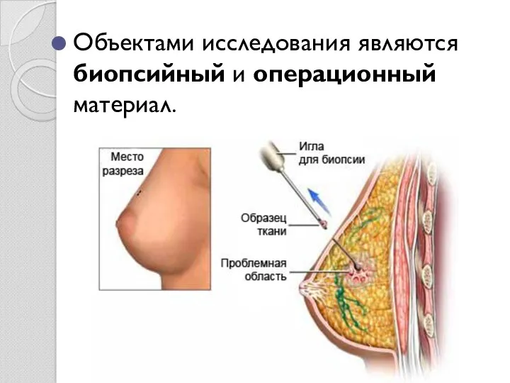 Объектами исследования являются биопсийный и операционный материал.