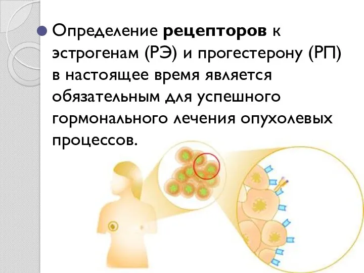 Определение рецепторов к эстрогенам (РЭ) и прогестерону (РП) в настоящее