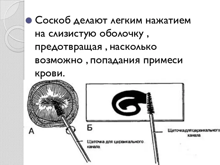 Соскоб делают легким нажатием на слизистую оболочку , предотвращая , насколько возможно , попадания примеси крови.