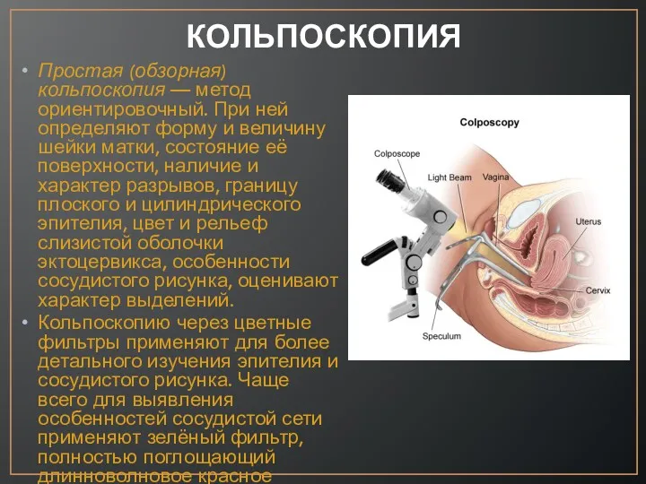 КОЛЬПОСКОПИЯ Простая (обзорная) кольпоскопия — метод ориентировочный. При ней определяют