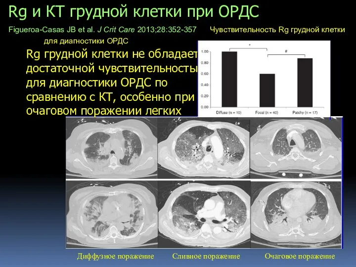 Диффузное поражение Очаговое поражение Сливное поражение Rg и КТ грудной