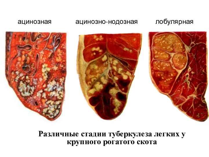 Различные стадии туберкулеза легких у крупного рогатого скота ацинозная ацинозно-нодозная лобулярная