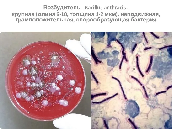 Возбудитель - Bacillus anthracis - крупная (длина 6-10, толщина 1-2 мкм), неподвижная, грамположительная, спорообразующая бактерия