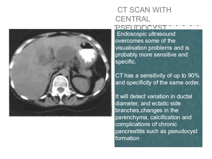 CT SCAN WITH CENTRAL PSEUDOCYST Endoscopic ultrasound overcomes some of