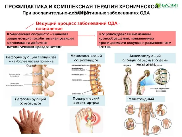 ПРОФИЛАКТИКА И КОМПЛЕКСНАЯ ТЕРАПИЯ ХРОНИЧЕСКОЙ БОЛИ При воспалительно-дегенеративных заболеваниях ОДА