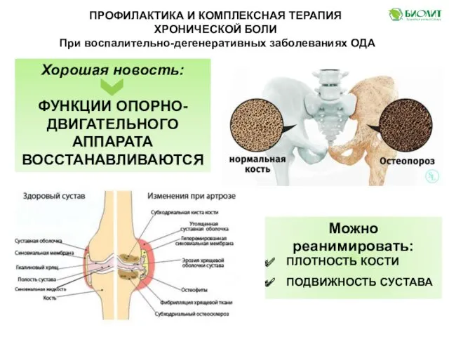 ПРОФИЛАКТИКА И КОМПЛЕКСНАЯ ТЕРАПИЯ ХРОНИЧЕСКОЙ БОЛИ При воспалительно-дегенеративных заболеваниях ОДА