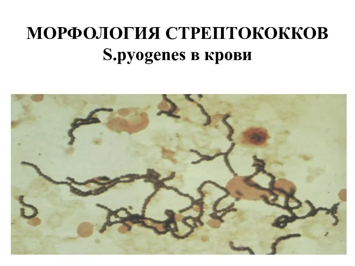 МОРФОЛОГИЯ СТРЕПТОКОККОВ S.pyogenes в крови