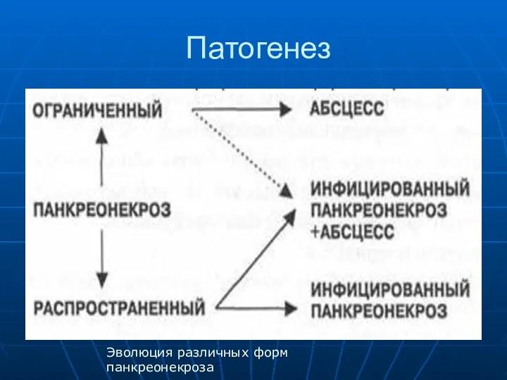 Патогенез Эволюция различных форм панкреонекроза