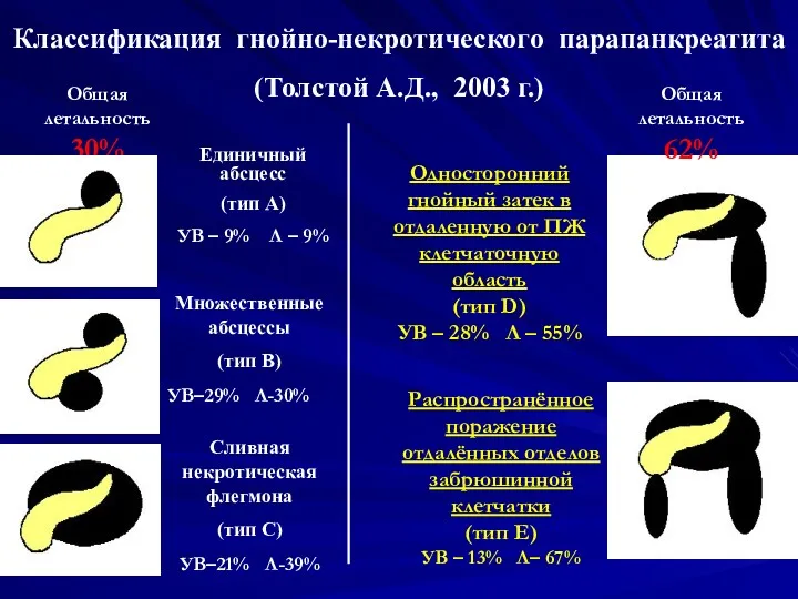 Единичный абсцесс (тип А) УВ – 9% Л – 9%