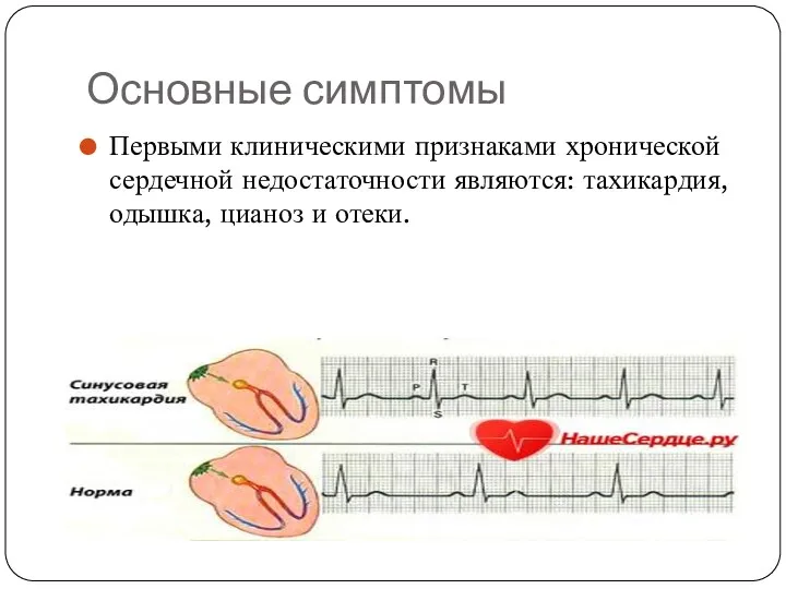 Основные симптомы Первыми клиническими признаками хронической сердечной недостаточности являются: тахикардия, одышка, цианоз и отеки.