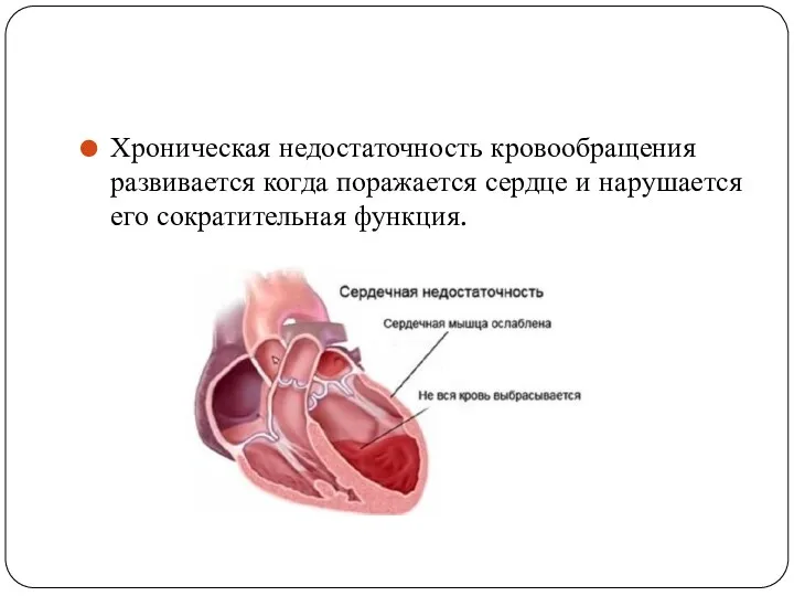 Хроническая недостаточность кровообращения развивается когда поражается сердце и нарушается его сократительная функция.