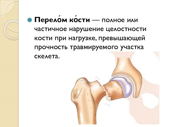 Перело́м ко́сти — полное или частичное нарушение целостности кости при нагрузке, превышающей прочность травмируемого участка скелета.