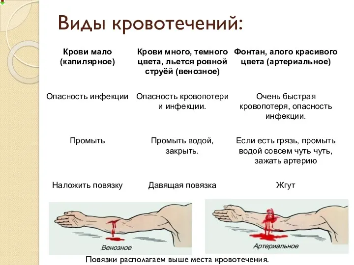 Виды кровотечений: Повязки располагаем выше места кровотечения.