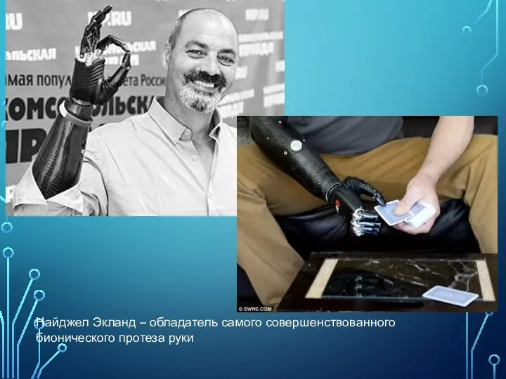 Найджел Экланд – обладатель самого совершенствованного бионического протеза руки