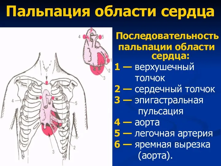 Пальпация области сердца Последовательность пальпации области сердца: 1 — верхушечный