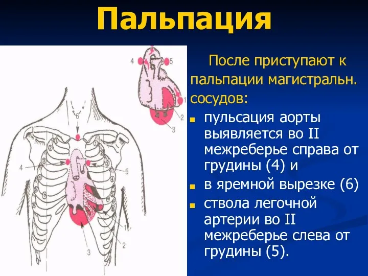 Пальпация После приступают к пальпации магистральн. сосудов: пульсация аорты выявляется