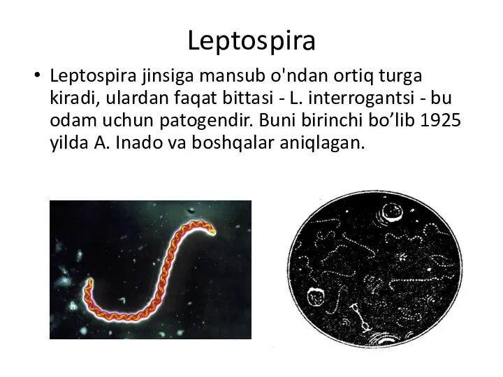 Leptospira Leptospira jinsiga mansub o'ndan ortiq turga kiradi, ulardan faqat