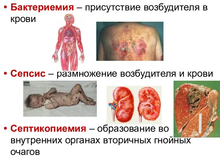 Бактериемия – присутствие возбудителя в крови Сепсис – размножение возбудителя