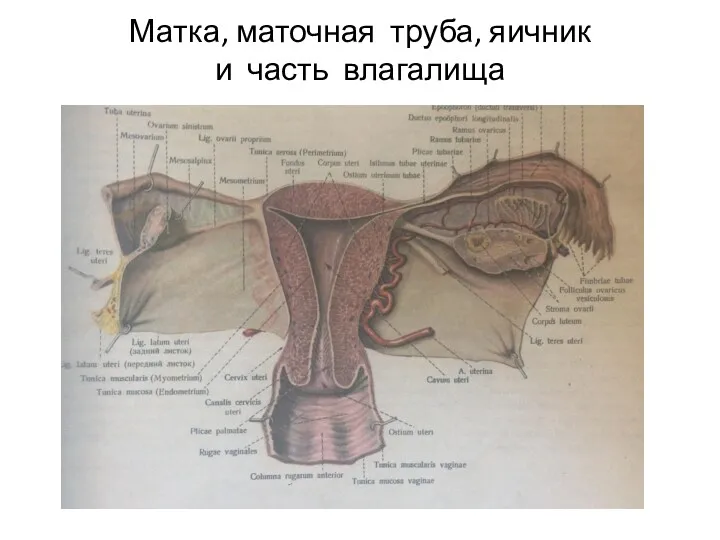 Матка, маточная труба, яичник и часть влагалища