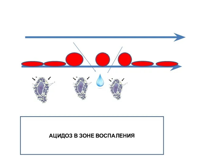 АЦИДОЗ В ЗОНЕ ВОСПАЛЕНИЯ