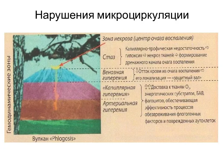 Нарушения микроциркуляции