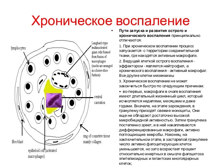 Хроническое воспаление Пути запуска и развития острого и хронического воспаления