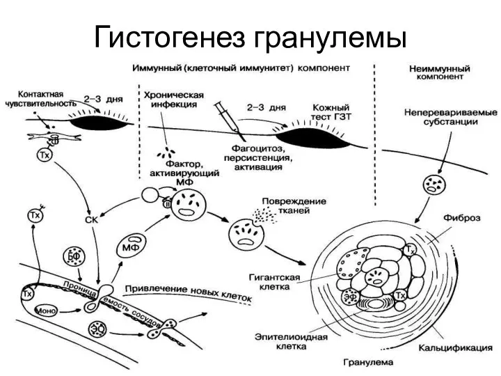 Гистогенез гранулемы