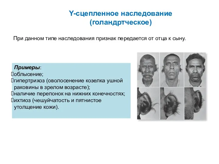 Y-сцепленное наследование (голандртческое) При данном типе наследования признак передается от