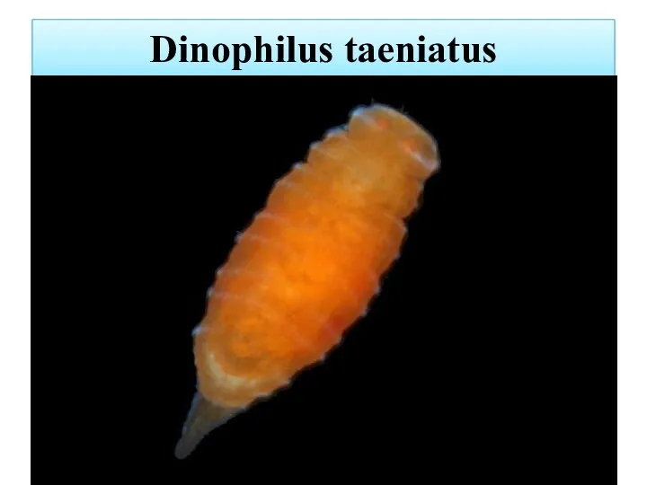 Dinophilus taeniatus