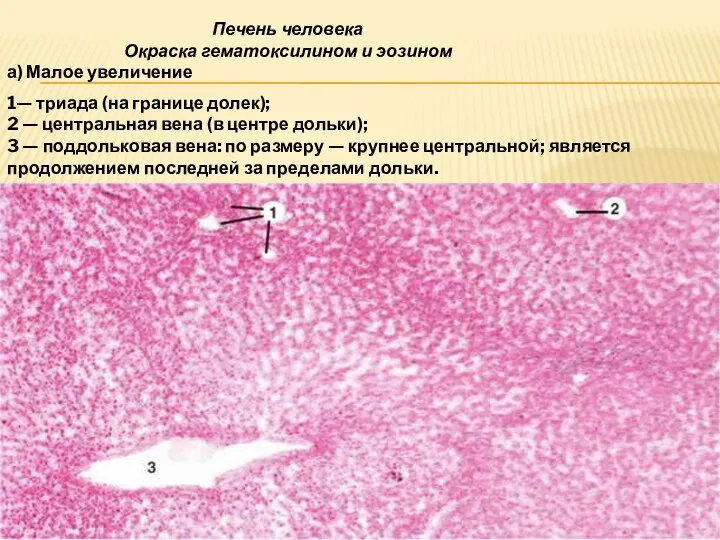 Печень человека Окраска гематоксилином и эозином а) Малое увеличение 1—