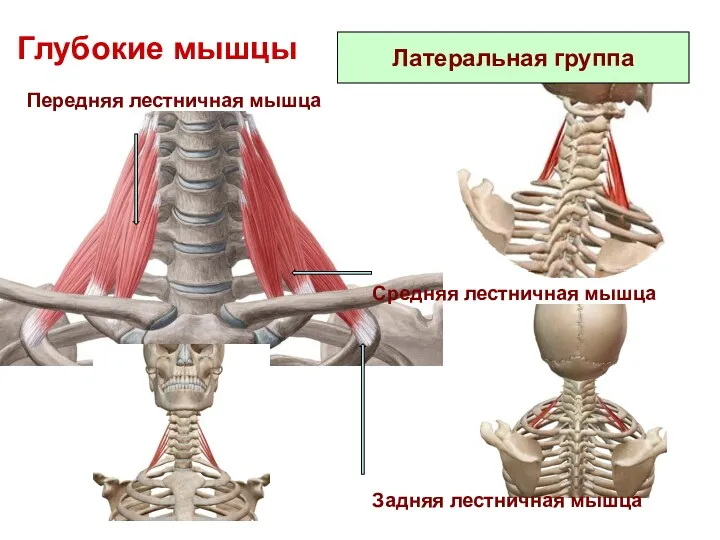 Глубокие мышцы Передняя лестничная мышца Латеральная группа Средняя лестничная мышца Задняя лестничная мышца