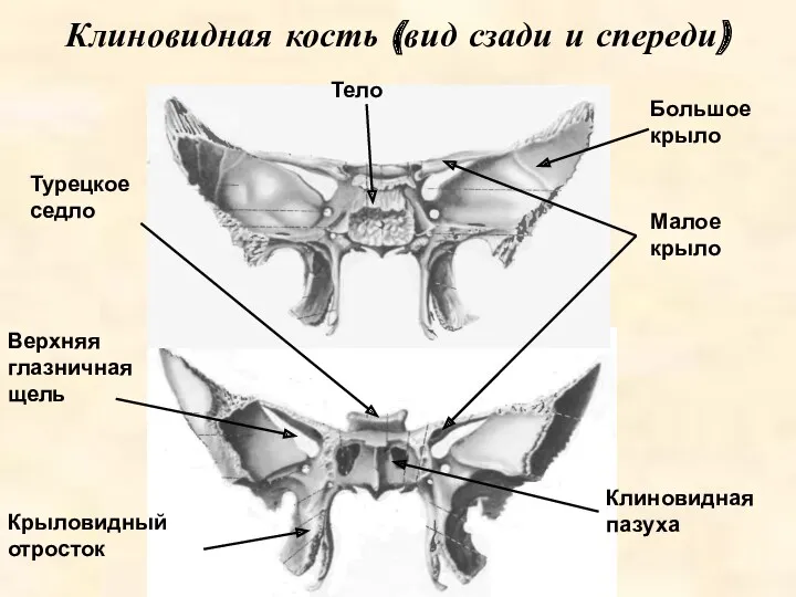 Клиновидная кость (вид сзади и спереди) Тело Клиновидная пазуха Верхняя