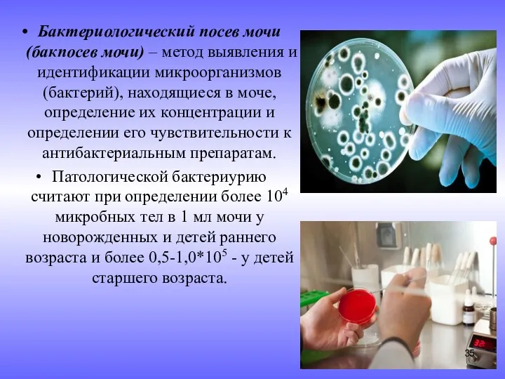 Бактериологический посев мочи (бакпосев мочи) – метод выявления и идентификации микроорганизмов (бактерий), находящиеся