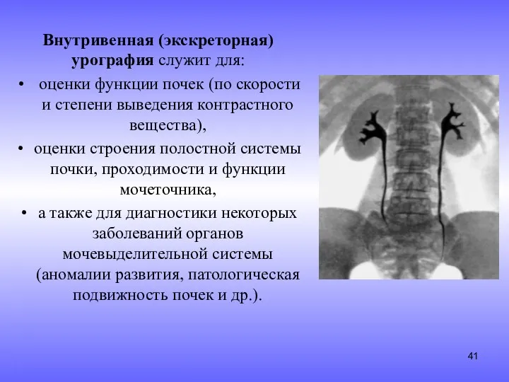 Внутривенная (экскреторная) урография служит для: оценки функции почек (по скорости и степени выведения