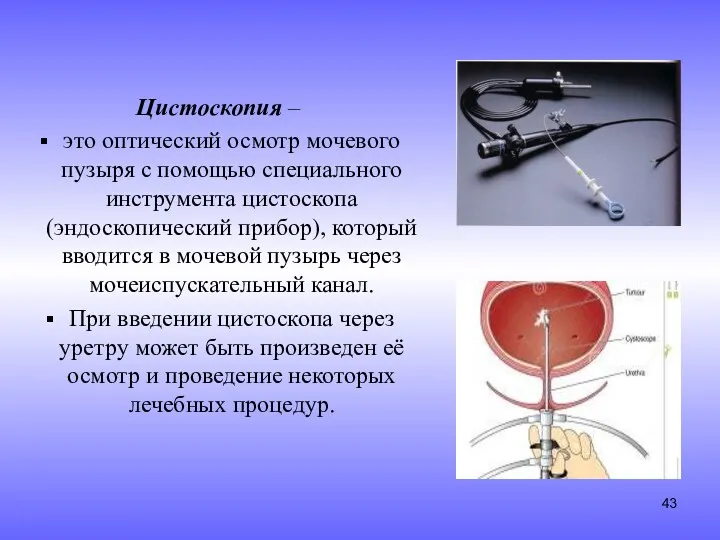 Цистоскопия – это оптический осмотр мочевого пузыря с помощью специального инструмента цистоскопа (эндоскопический