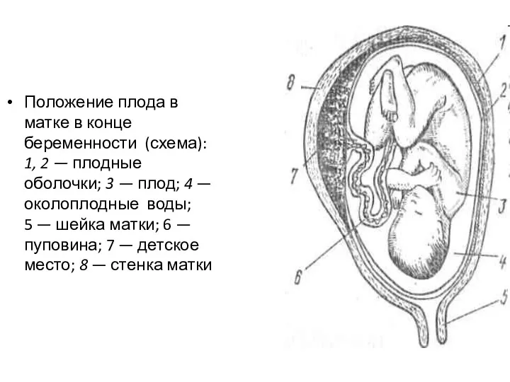 Положение плода в матке в конце беременности (схема): 1, 2 — плодные оболочки;