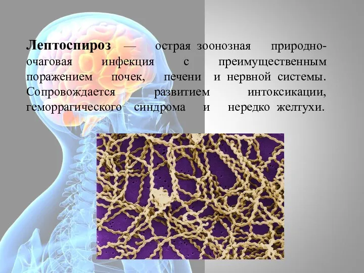 Лептоспироз — острая зоонозная природно-очаговая инфекция с преимущественным поражением почек,