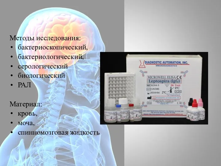 Методы исследования: бактериоскопический, бактериологический, серологический биологический РАЛ Материал: кровь, моча, спинномозговая жидкость