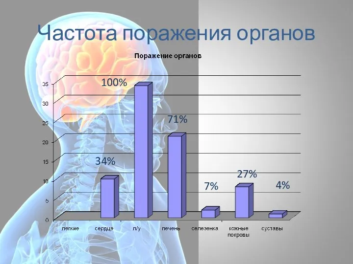 Частота поражения органов 34% 71% 7% 27% 4% 100%
