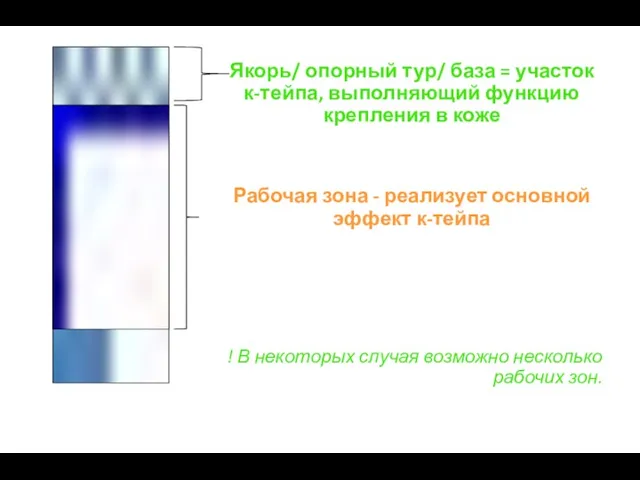 Якорь/ опорный тур/ база = участок к-тейпа, выполняющий функцию крепления