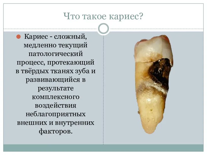 Что такое кариес? Кариес - сложный, медленно текущий патологический процесс,