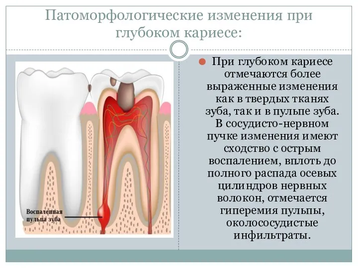 Патоморфологические изменения при глубоком кариесе: При глубоком кариесе отмечаются более