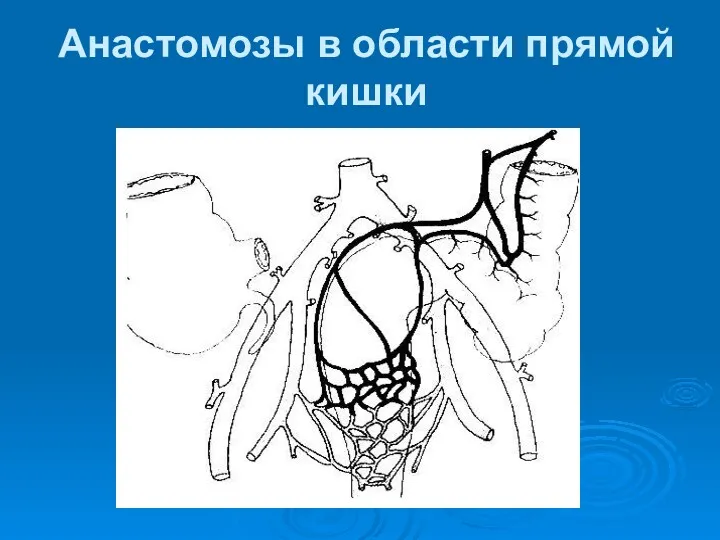 Анастомозы в области прямой кишки