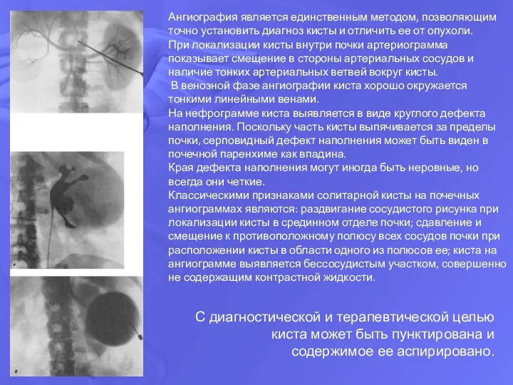 С диагностической и терапевтической целью киста может быть пунктирована и