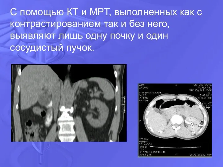 С помощью КТ и МРТ, выполненных как с контрастированием так