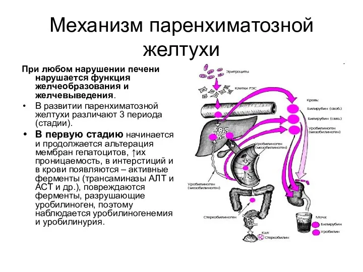 Механизм паренхиматозной желтухи При любом нарушении печени нарушается функция желчеобразования