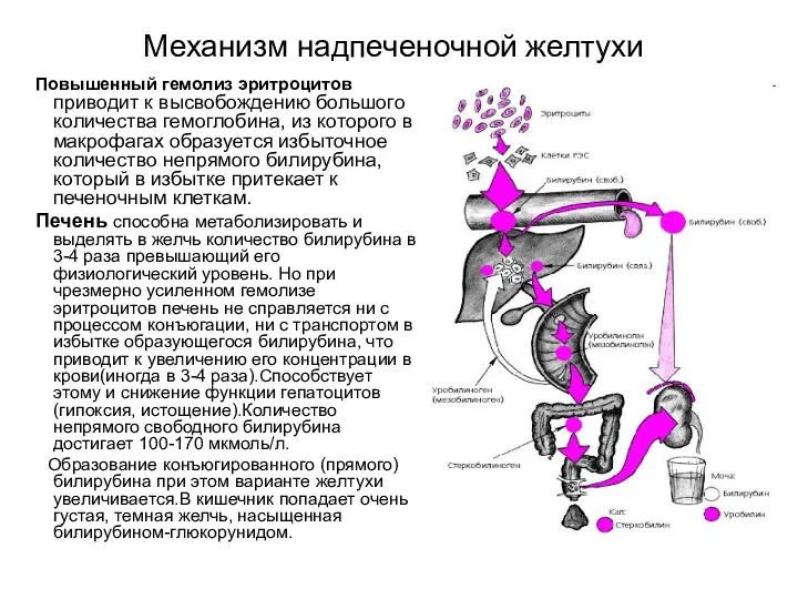 Механизм надпеченочной желтухи Повышенный гемолиз эритроцитов приводит к высвобождению большого