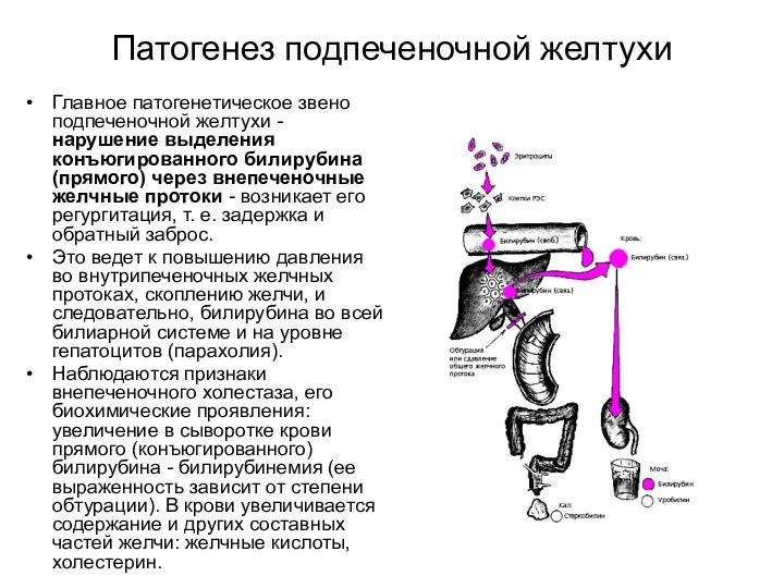 Патогенез подпеченочной желтухи Главное патогенетическое звено подпеченочной желтухи - нарушение